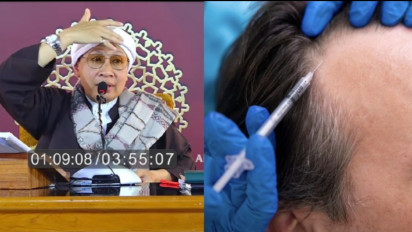 Apa Hukum Tanam Rambut dalam Islam, Apakah Dibolehkan? Ini Jawaban Buya Yahya ..