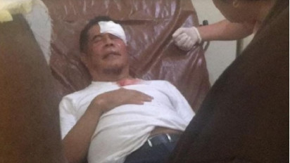 Jenguk Pj Gubernur Papua yang Terluka Akibat Rusuh Massa Saat Prosesi Pemakaman Lukas Enembe, Kapolresta Jayapura Sebut Ridwan Rumahsukun Kondisinya Mulai Stabil