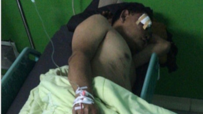 Tragis! Sekeluarga Di Garut Jadi Korban Amukan Geng Motor Saat Hendak ke Puskesmas, Kakak Beradik Babak Belur Sang Paman Luka Parah