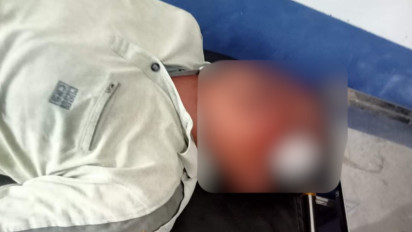 Saksi Paslon Presiden Prabowo-Gibran Bonyok Dihajar Saat PSU di Tapteng