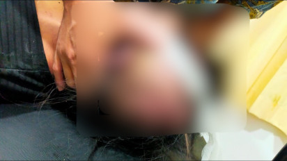 Tragis! WNA Singapura Tewas Saat Bermain Go Kart di Golden Prawn Batam