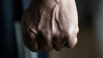 Kasus Penganiayaan Sekuriti di Rumah Sakit Bekasi Naik ke Penyidikan, Terlapor Bakal Dipanggil