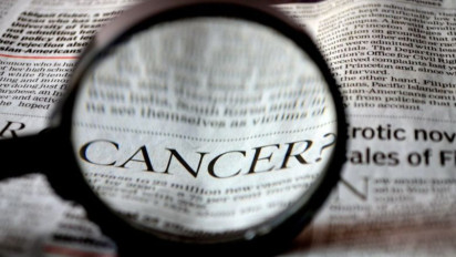 Waspada, Dokter THT Sebut Ingus Campur Darah Bisa Jadi Tanda Kanker Nasofaring