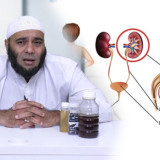 Batu Ginjal Bisa Hancur Tanpa Harus Operasi di Rumah Sakit, Cukup Pakai Obat Alami Ini Kata dr Zaidul Akbar, Asalkan ...