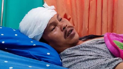 Kisah Petani di Lampung Barat yang Selamat dari Terkaman Harimau Sumatera