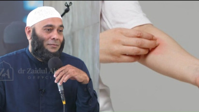 Alergi Makin Menganggu? dr Zaidul Akbar Ungkap Cara Alami Mangatasi Alergi, Ini Dia ...