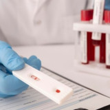 Tekan Angka Penyebaran, Kemenkes Minta Masyarakat Tidak Takut Cek HIV Lebih Awal