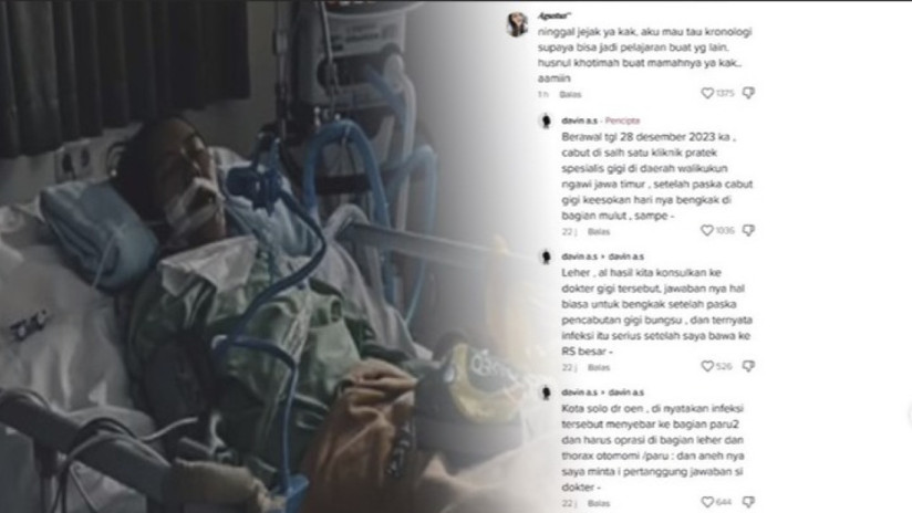 Viral, Curhatan Sedih Suami, Sang Istri Tewas Usai Cabut Gigi di ...