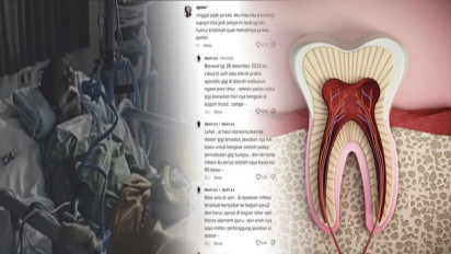 Soal Viralnya Wanita di Ngawi Tewas karena Cabut Gigi Bungsu, Dokter Jelaskan Ini