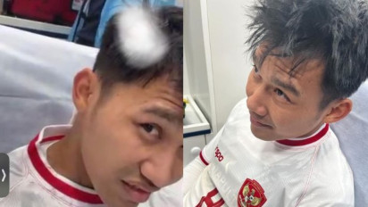 Istri Witan Sulaeman Bagikan Foto Mengerikan Luka Suaminya usai Timnas Indonesia U-23 Kalah dari Guinea, Berdarah hingga Rambut Terkelupas