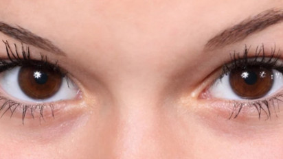 Mengenal Prosedur LASIK yang Jadi Penyelamat untuk Masalah Mata Minus