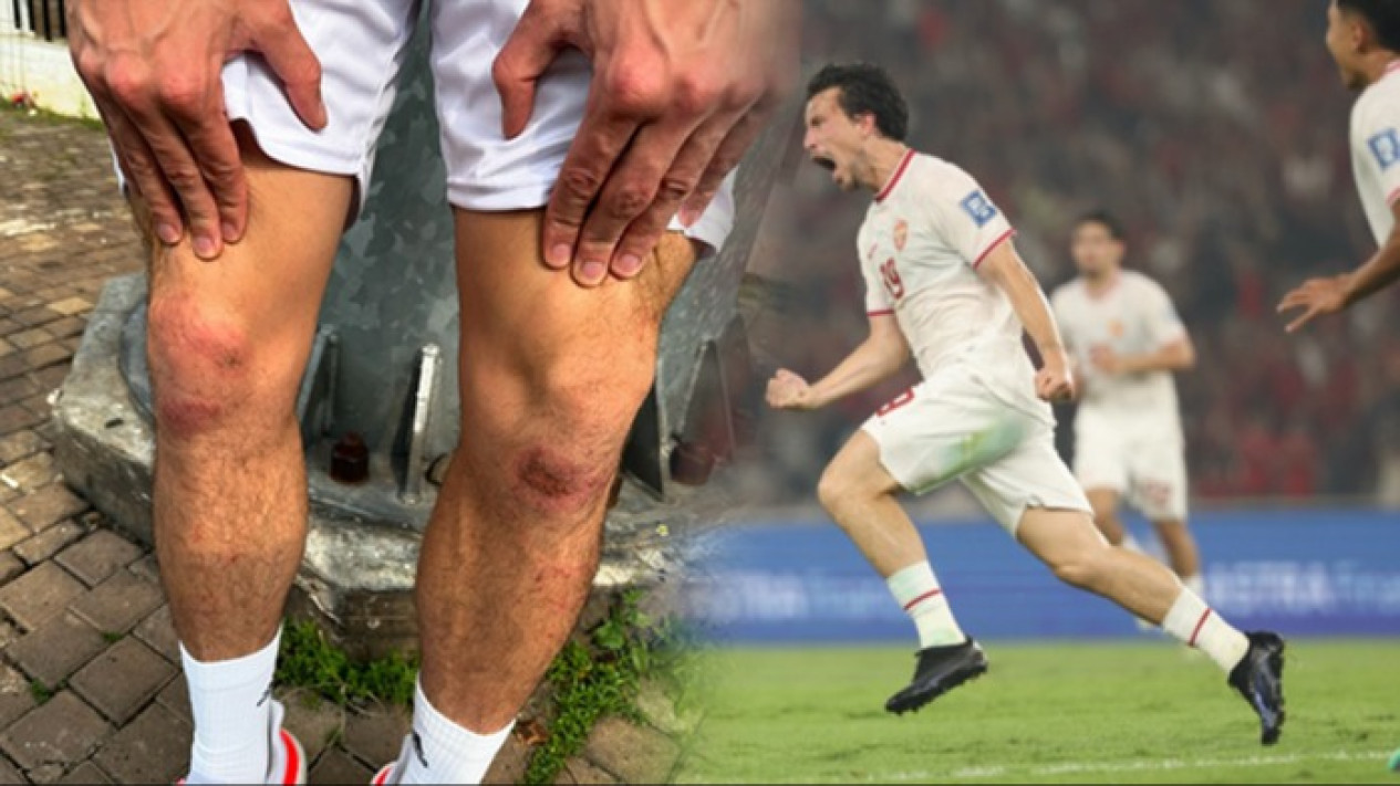 Foto Dengkul Thom Haye yang Lecet setelah Selebrasi Knee Slide untuk Gol Pertamanya bagi Timnas Indonesia, Coach Justin Salahkan Rumput GBK
            - galeri foto