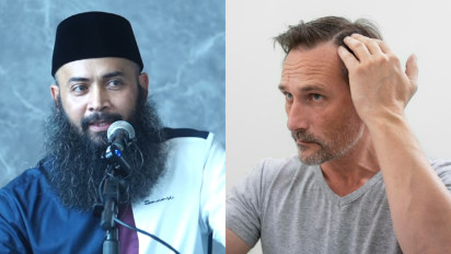 Meski Kepala Terasa Gatal, Ustaz Syafiq Riza Basalamah Bilang Jangan Pernah Cabut Uban, itu karena Rasulullah SAW...