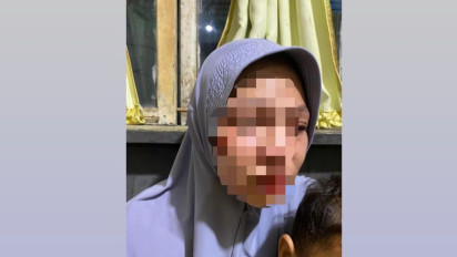 Seorang Wanita Babak Belur Dianiaya Suami, Polres Madina Belum Tetapkan Tersangka