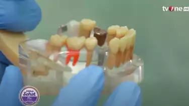 Ilustrasi efek samping gigi ompong yang dibiarkan begitu saja dari drg. Kim Seong Seon. Source: YouTube tvOnenews