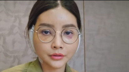 Tak Terima Dihujat Netizen Saat Tampil Tanpa Makeup, Sarwendah Memilih Lakukan Oplas, Mantan Istri Ruben Onsu itu Bilang: Kalau di Live...