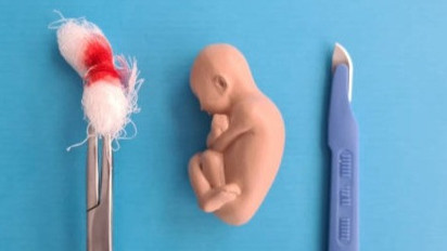 Aturan Aborsi Legal yang Diteken Jokowi di PP Kesehatan Terbaru, Boleh Dilakukan dengan Syarat dan Cara Berikut Ini 