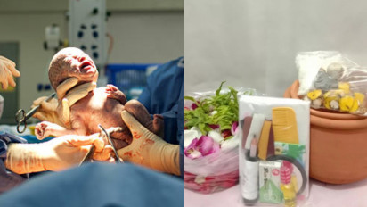 Mengubur Ari-ari Bayi Pake Kendi, Kain Kafan, dan Ritual Khusus Memangnya Boleh? Ustaz Khalid Basalamah Bilang Tegas: Itu Bukan Saudaranya Anak...