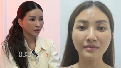 Reaksi Anak-anak Sarwendah Melihat Wajah Bundanya Setelah Operasi Plastik di Korea Selatan: Mereka Malah...