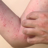 Mengerikan! 88 Kasus Cacar Monyet Ada di Indonesia, Diduga dari Hubungan Sesama Jenis, Ingatkan Pesan Ustaz Adi Hidayat Bisa Tak Melahirkan Generasi yang...