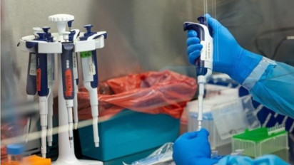 Indonesia Bersiap soal Bahaya Calon Pandemi Virus MPox 'Cacar Monyet', Kemenkes Siapkan 4.450 Dosis Vaksin