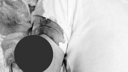 Pria di Bekasi Dibacok Begal saat Berangkat Mengikuti Seleksi Masuk TNI, Polisi Beberkan Kronologisnya