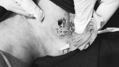 Seorang Pelajar Tewas Ditembak di Serdang Bedagai, 2 Peluru Menembus Tubuhnya