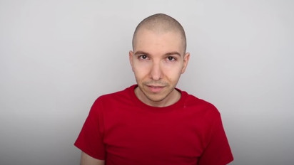 YouTuber Mukbang Nikocado Avocado Bikin Gempar, Berhasil Turunkan Berat Badan Hingga 113 Kilogram