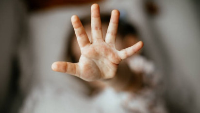 Terungkap, Kronologi Dua Bocah Dianiaya Ibu Tiri di Cilincing, Ditemukan dengan Kondisi Mengenaskan