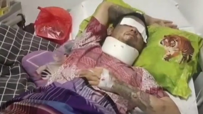 Fakta dan Kondisi Terkini Pria Korban Tragedi Congkel Mata di Bogor, Kakak Korban: Berita yang Beredar di Luar Itu Hoaks Semua