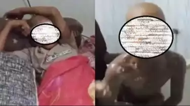 Kolase foto santri berinisial T usai disiram air cabai oleh istri pimpinan pesantren berinisial NN (40) di Aceh Barat