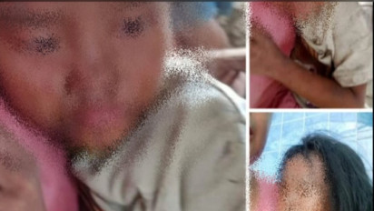 Viral, Kronologi Ibu Angkat Aniaya Bocah 7 Tahun, Pelaku Sempat Lakukan Ini ke Tubuh Korbannya