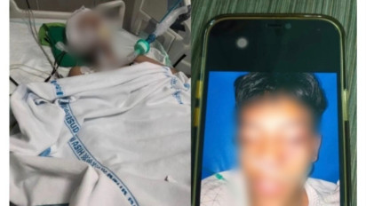 Mengerikan, Siswa MA As-Syafi'iyah Jakarta Selatan Alami Koma Usai Dianiaya Kakak Kelasnya, Polisi: Proses Penanganan