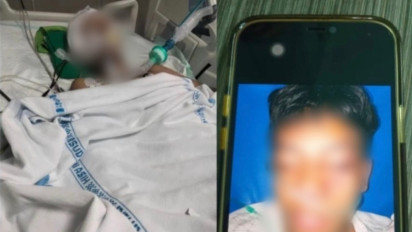 Update! Kasus Siswa MA Assyafi'iyah Dianiaya Kakak Kelas Hingga Koma di Tebet Naik Penyidikan