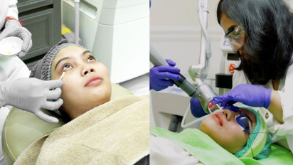 Ada Promo Spesial ZAP dari BRI, Yuk Manfaatkan Buat Perawatan Wajah di Klinik Kecantikan Terkemuka