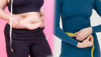 Tak Perlu Pil Pelangsing, Ini Tips Diet Sehat Tanpa Olahraga ala dr Zaidul Akbar: Pagi-Pagi Minum Kopi, tapi Jangan...