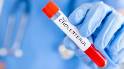 Tanpa Berobat ke Dokter, Kolesterol Jahat Auto Minggat, Berikut Penjelasan dr Zaidul Akbar