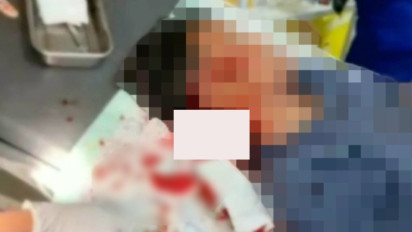 Pemuda di Nganjuk Dibacok Orang Tak Dikenal saat Pulang Kerja, Keluarga Tuntut Pelaku Segera Ditangkap