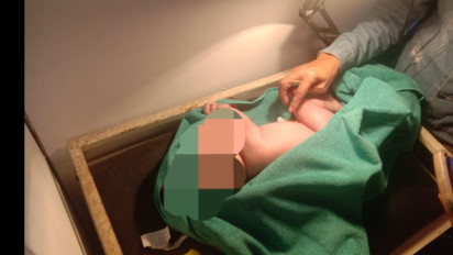 Tega! Bayi Baru Lahir Terbungkus Kantong Kresek Ditemukan di Saung Kebun 