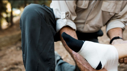 Keringkan Luka Bekas Kecelakaan dengan 5 Cara Ini