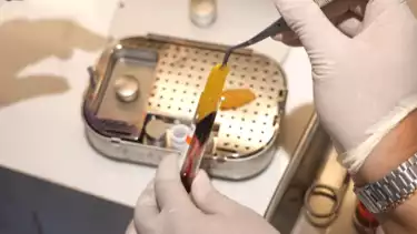 Proses penanganan pasien gigi goyang di Devya Dental Clinic.