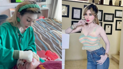 Dokter Klinik Kecantikan Abal-abal Ria Beauty Ternyata Pernah Treatment Ekstrem ke Diri Sendiri