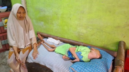 Anak 10 Tahun di Marunda Punya Berat Badan 9 Kilogram, Ternyata Gara-Gara Ini