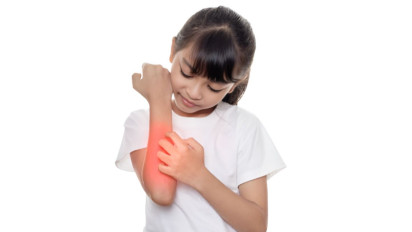 7 Rekomendasi Salep dan Obat Ampuh Hilangkan Gatal di Kulit Anak