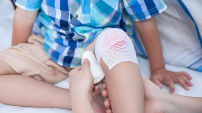 7 Rekomendasi Obat Ampuh untuk Luka Terbuka agar Cepat Kering, Nomor 5 Paling Efektif Bikin Luka Hilang Tanpa Bekas