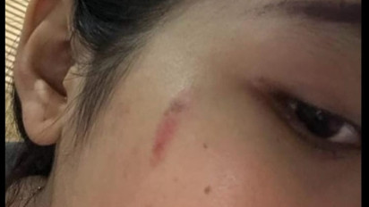 Viral Oknum Polisi Diduga Aniaya Kekasih Hingga Memar, Polda Jabar Bergerak