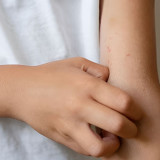 Sering Dianggap Sepele, Kenali Tanda-Tanda Bisul Penderita Diabetes Dibandingkan dengan Bisul Biasa