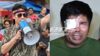 Agus Makin Nelangsa, Denny Sumargo Masa Bodoh soal Ancaman Penjara dari Farhat Abbas, Donasi Rp 1,3 Miliar Tetap Meluncur ke NTT: Tujuan Kita...