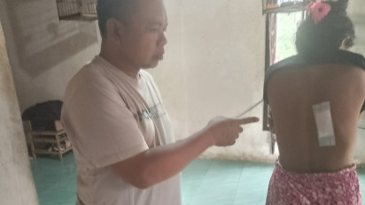 Tujuh Warga Jember Terluka Akibat Serangan Kera Liar, BKSDA Sebut Jebakan Tak Efektif