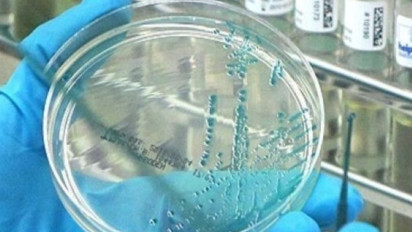 Waspada! Badan Kesehatan Inggris Pastikan Kasus Langka Flu Burung pada Manusia